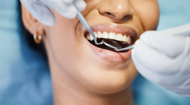 Best Emergency Tooth Extraction in Braselton, GA