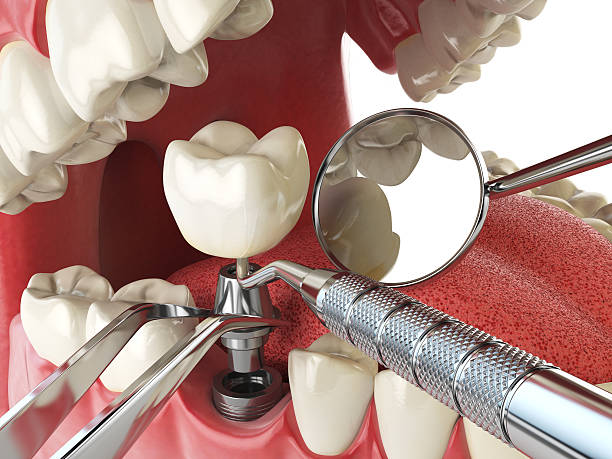 Best Emergency Dental Surgery in Braselton, GA